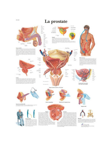 planche anatomique - la prostate